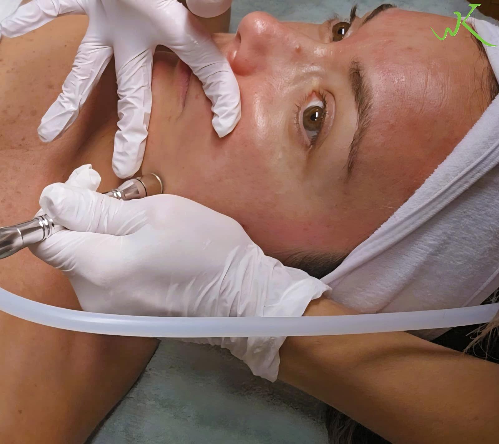 Dermabrasion skin therapy gentle